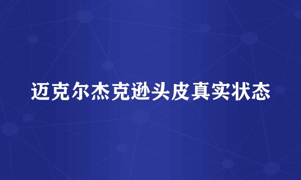 迈克尔杰克逊头皮真实状态