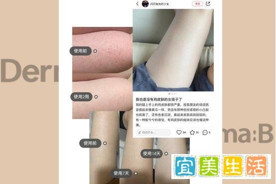身体护理界的宝藏,鸡皮肤的绝对克星!