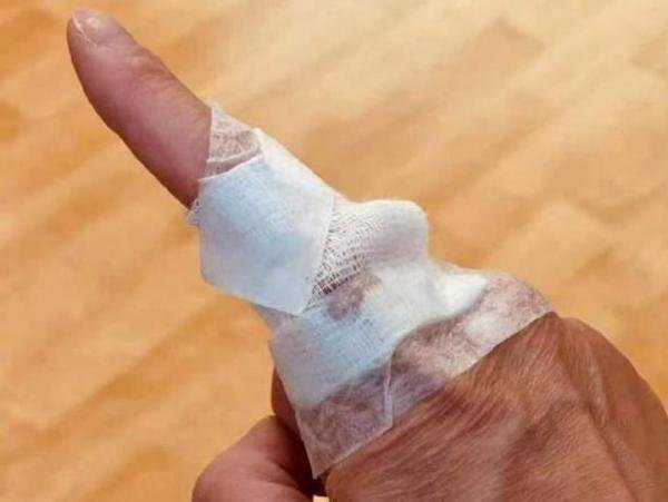 陶喆取出放在手指里15年的螺丝 回忆起那场车祸的细节