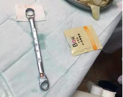 男子某处被扳手套住17小时是怎么回事？