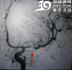 访瑞康医院神经内科主任任丁