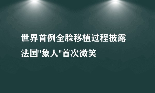 世界首例全脸移植过程披露 法国