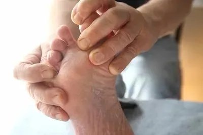 脚趾甲变黄变厚怎么治