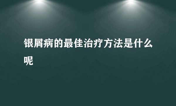 银屑病的最佳治疗方法是什么呢