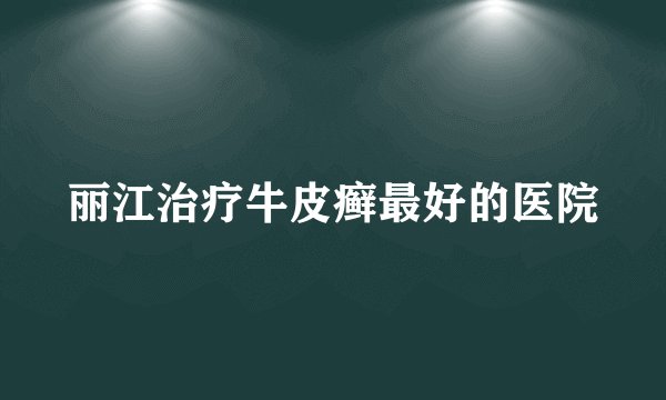 丽江治疗牛皮癣最好的医院