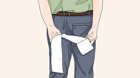 内痔的症状和治疗方法