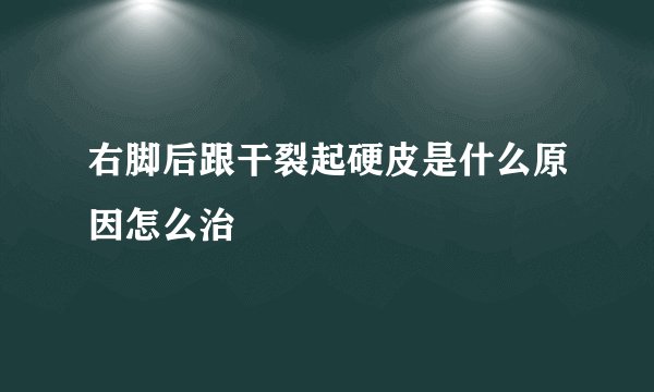 右脚后跟干裂起硬皮是什么原因怎么治