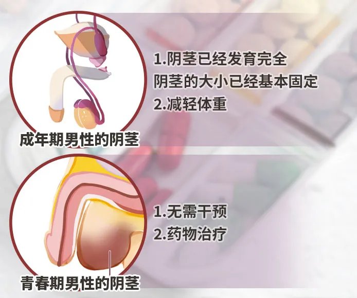 阴茎怎么变大