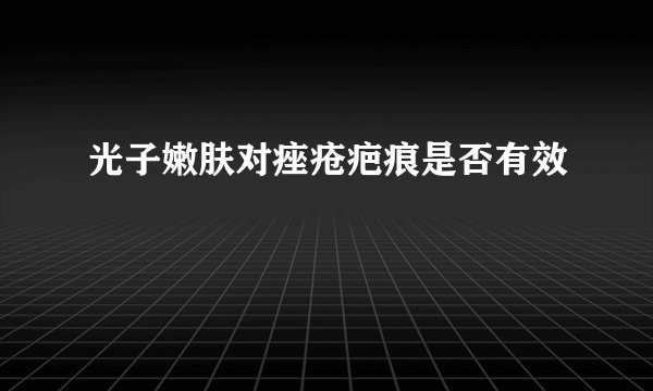 光子嫩肤对痤疮疤痕是否有效