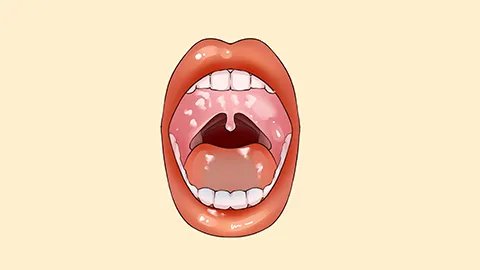 瓜子吃多了会上火吗