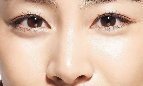 哪里开眼角比较好