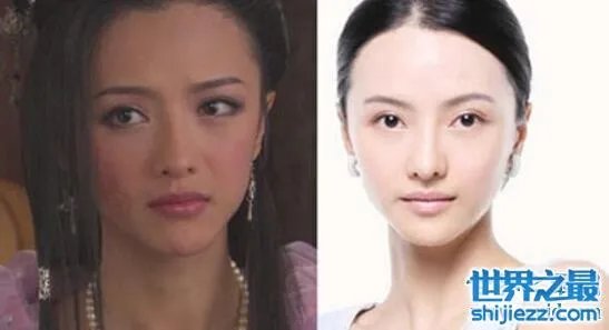 张芷溪整容前后对比照片，面部整容疤痕清晰可见 