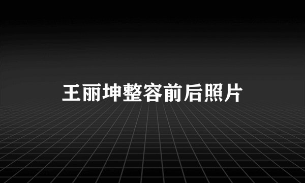 王丽坤整容前后照片