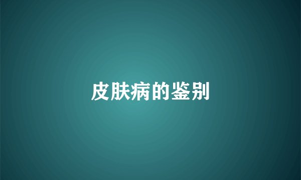 皮肤病的鉴别