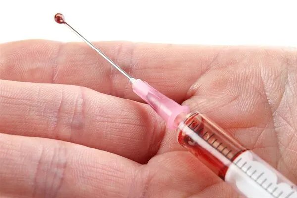 避免输血风险的最佳途径：自体血液回收