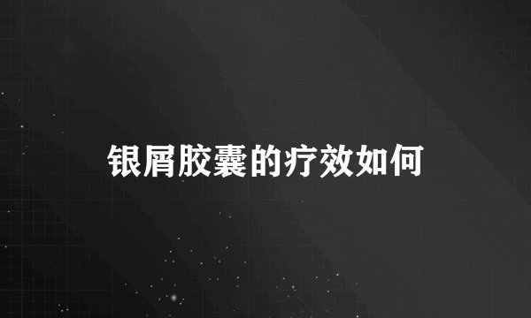 银屑胶囊的疗效如何