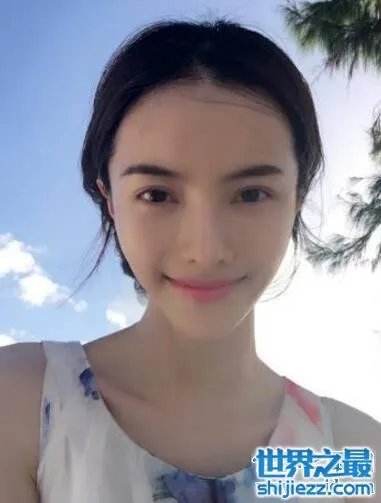 张芷溪整容前后对比照片，面部整容疤痕清晰可见 