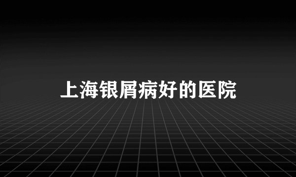 上海银屑病好的医院