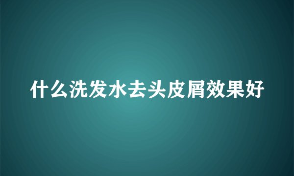什么洗发水去头皮屑效果好