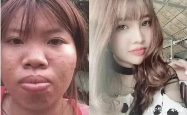 越南凤姐为了嫁入豪门,花10万整容成功,生下孩子后现状如何?