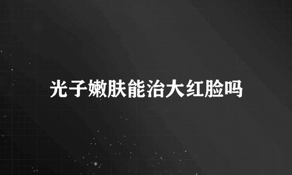 光子嫩肤能治大红脸吗