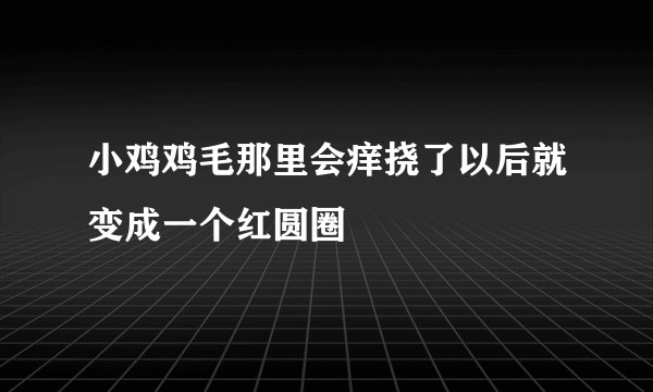 小鸡鸡毛那里会痒挠了以后就变成一个红圆圈