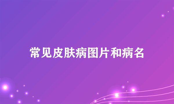 常见皮肤病图片和病名