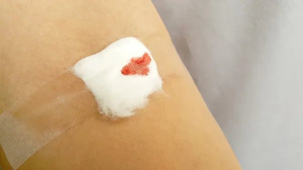 秋天保养皮肤的注意事项有哪些?秋天保养皮肤的注意事项都有什么