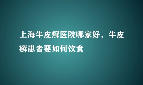 上海牛皮癣医院哪家好，牛皮癣患者要如何饮食