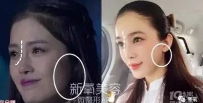 赵韩樱子整容前后:赵韩樱子是姓什么