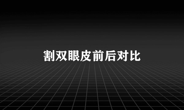 割双眼皮前后对比