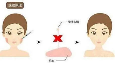 整形哪得好