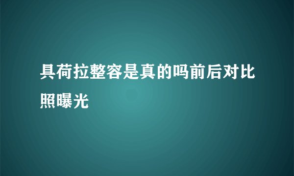 具荷拉整容是真的吗前后对比照曝光