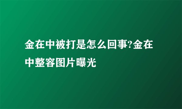 金在中被打是怎么回事?金在中整容图片曝光
