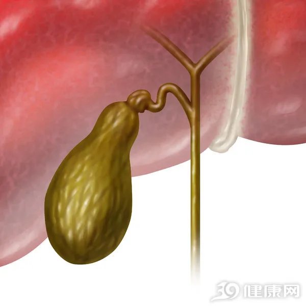胆结石好治疗吗