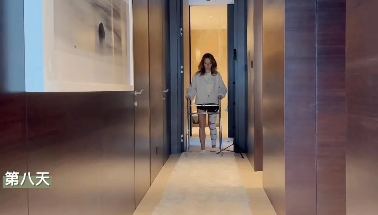 李玟得什么病了？小时候曾做过一次手术