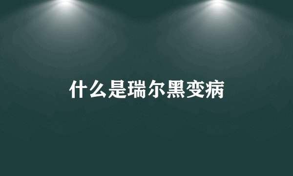 什么是瑞尔黑变病