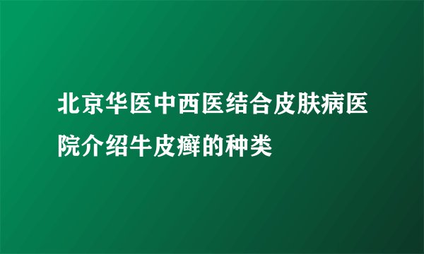 北京华医中西医结合皮肤病医院介绍牛皮癣的种类