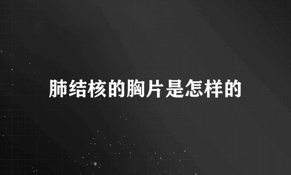 肺结核的胸片是怎样的