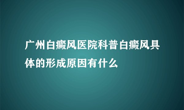 广州白癜风医院科普白癜风具体的形成原因有什么