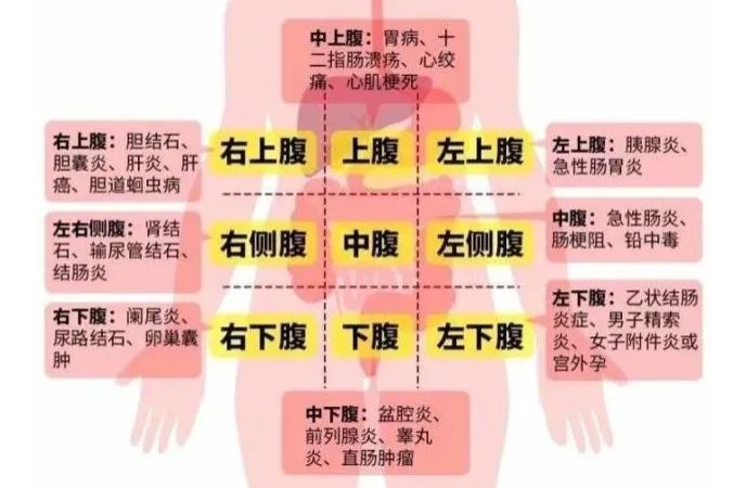 腹部各部位疼痛对照图