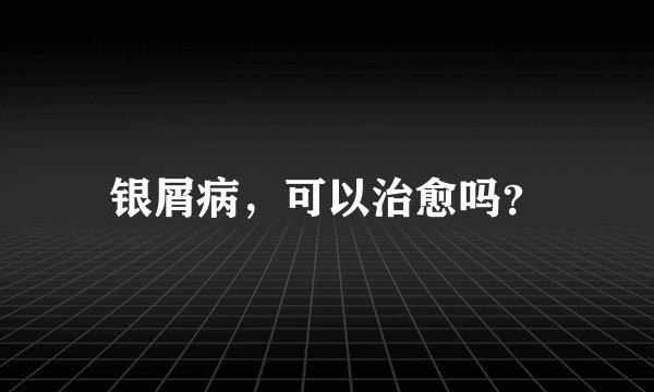 银屑病，可以治愈吗？