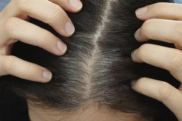 章光101治疗白发效果怎么样
