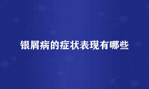 银屑病的症状表现有哪些