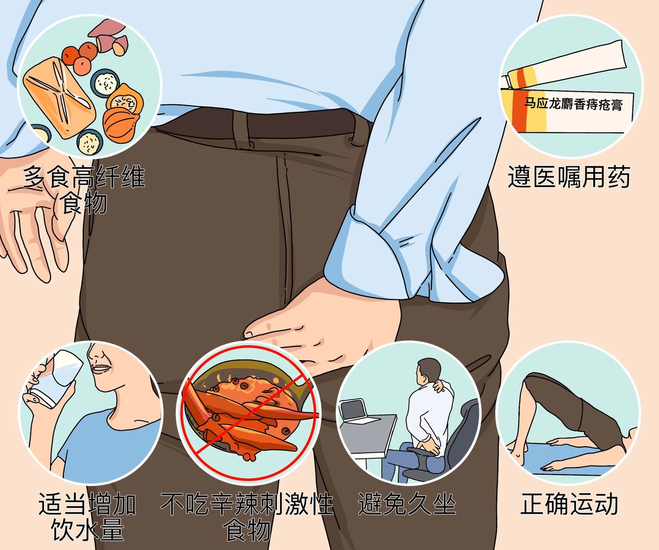 痔疮注意事项