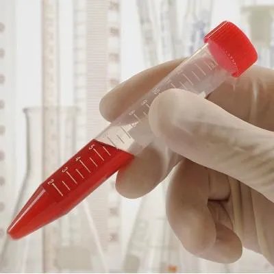 血红蛋白浓度偏高怎么回事