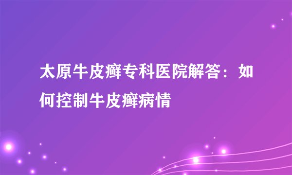 太原牛皮癣专科医院解答:如何控制牛皮癣病情