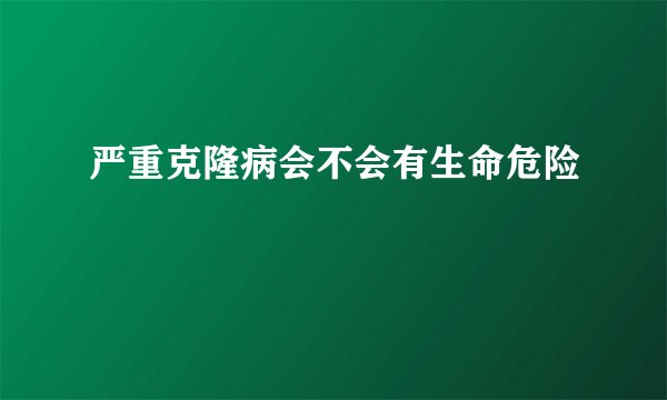 严重克隆病会不会有生命危险
