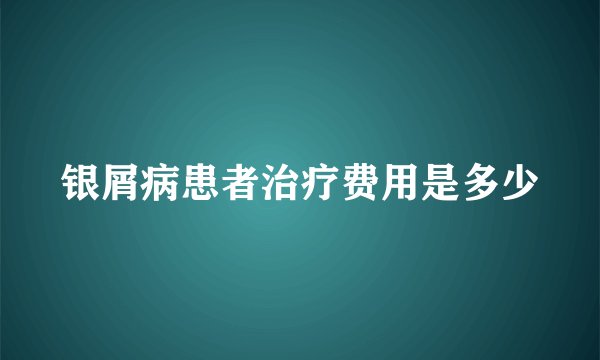 银屑病患者治疗费用是多少