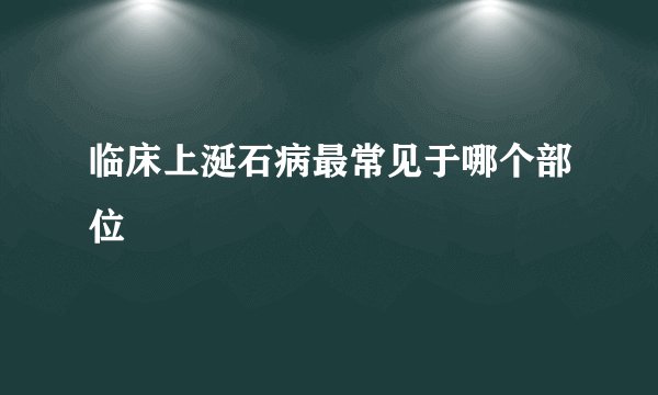 临床上涎石病最常见于哪个部位